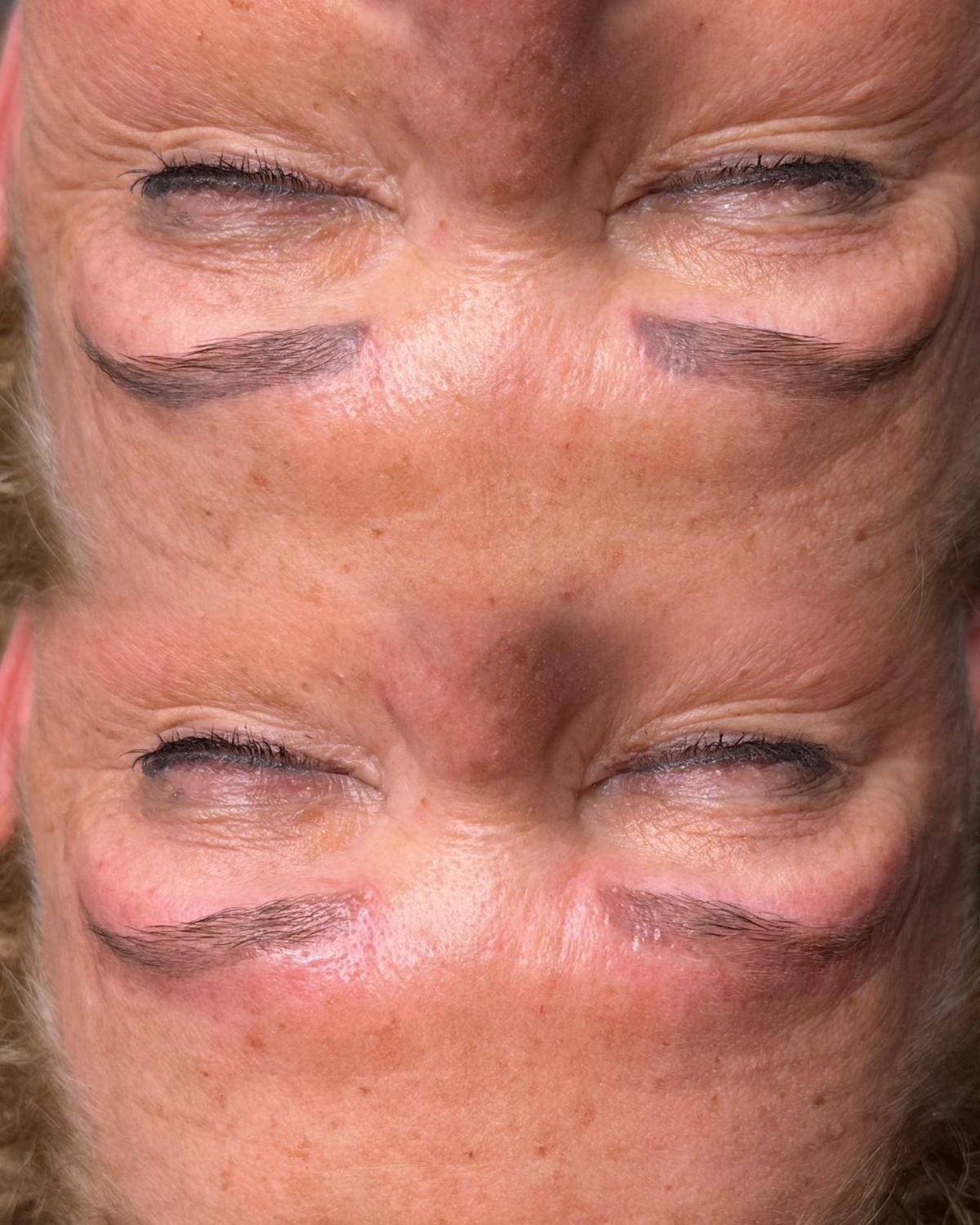 Vorher und Nachher: Aufhellung von verfärbtem Augenbrauen-Permanent-Make-up